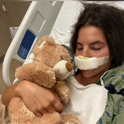 The Harrowing Story of a Young Model Whose Lip Was Torn Off by a Pit Bull