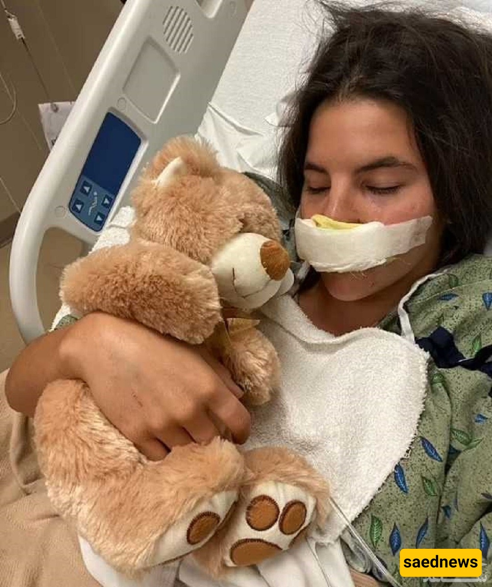 The Harrowing Story of a Young Model Whose Lip Was Torn Off by a Pit Bull