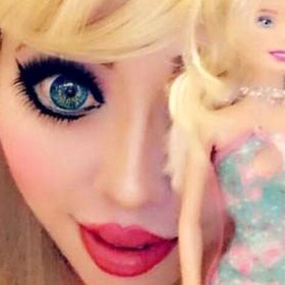 A 30-Year-Old Woman Undergoes Surgery Costing 200 Million to Look Like a Barbie Doll