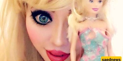 A 30-Year-Old Woman Undergoes Surgery Costing 200 Million to Look Like a Barbie Doll