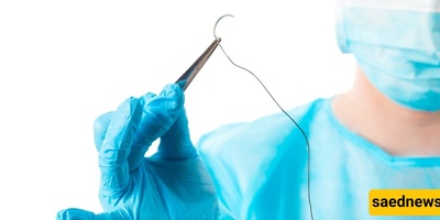 Preventing Infection in Natural Birth Stitches