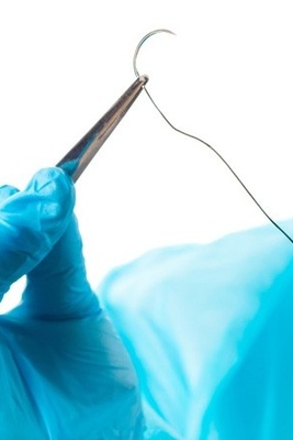 Preventing Infection in Natural Birth Stitches