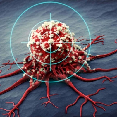 Risk Factor for Dying from Women’s Cancers Before Age 70 / Don’t Ignore These Warning Signs