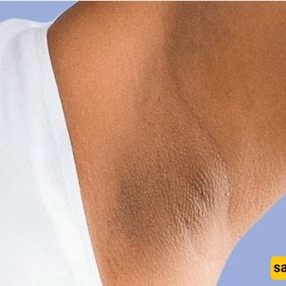 Does Deodorant Make Your Underarms Darker?