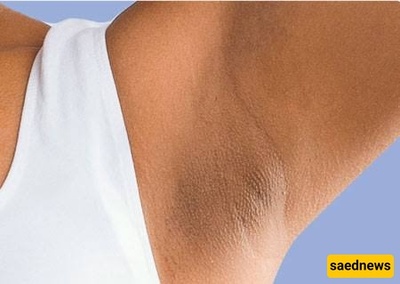 Does Deodorant Make Your Underarms Darker?