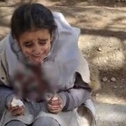 Behind the Scenes of the Bloody Face Incident of the Schoolgirl Due to Hijab!
