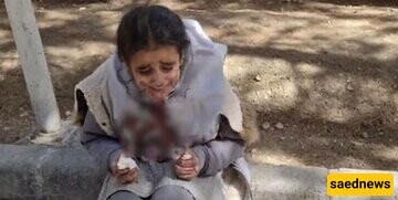Behind the Scenes of the Bloody Face Incident of the Schoolgirl Due to Hijab!