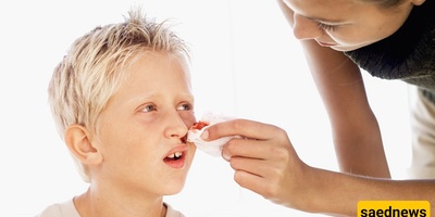 Is Nosebleeding in Children a Sign of Cancer?