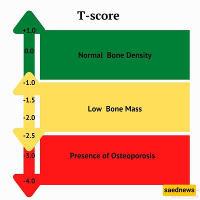 Amazing Strategies for Strengthening and Maintaining Children's Bone Health