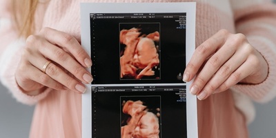 The Only Taste a Fetus Can Perceive in the Mother’s Womb